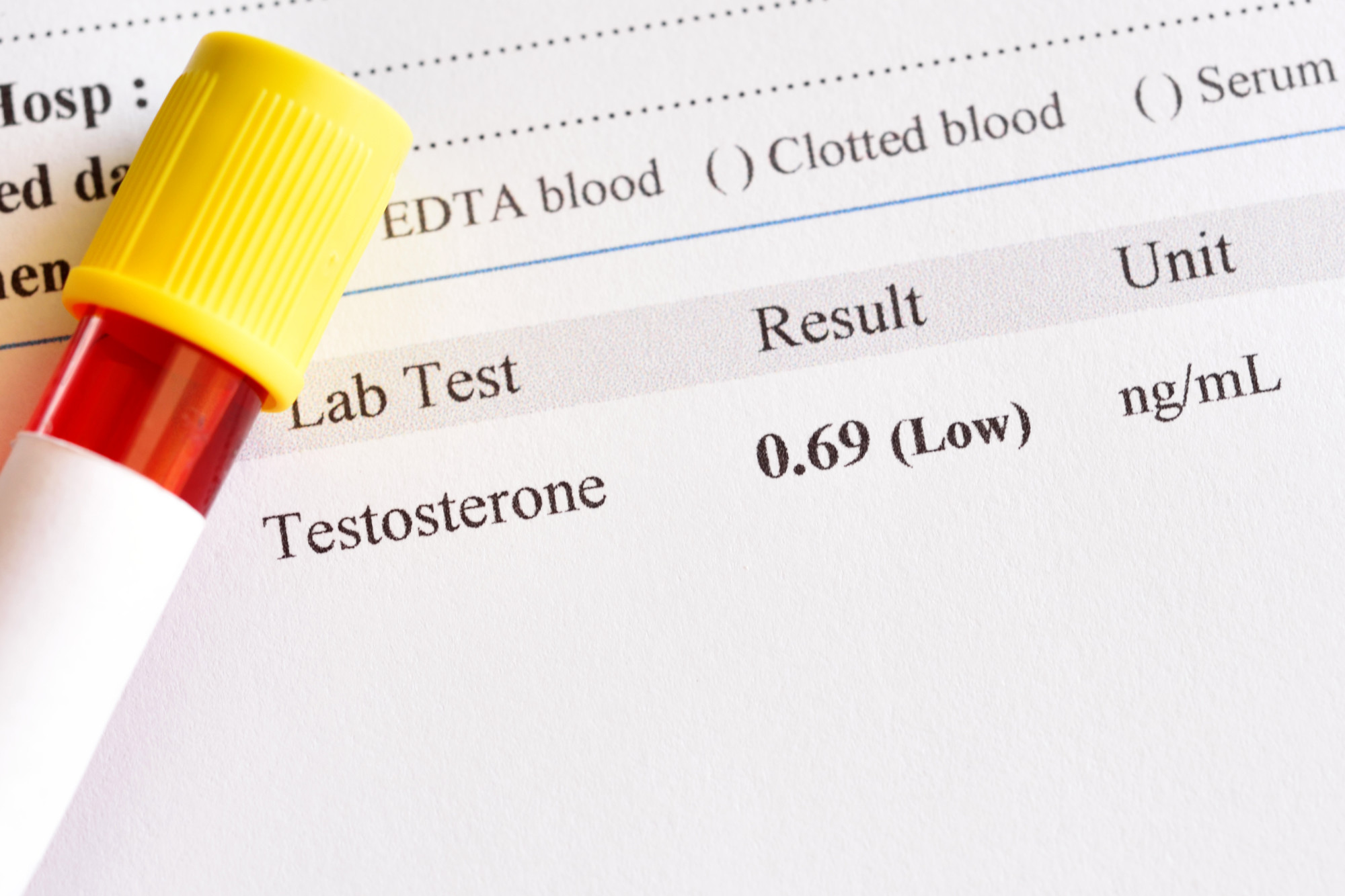 Finding the right low testosterone treatments can help you bounce back to your normal self, and get your hormone health back on track.