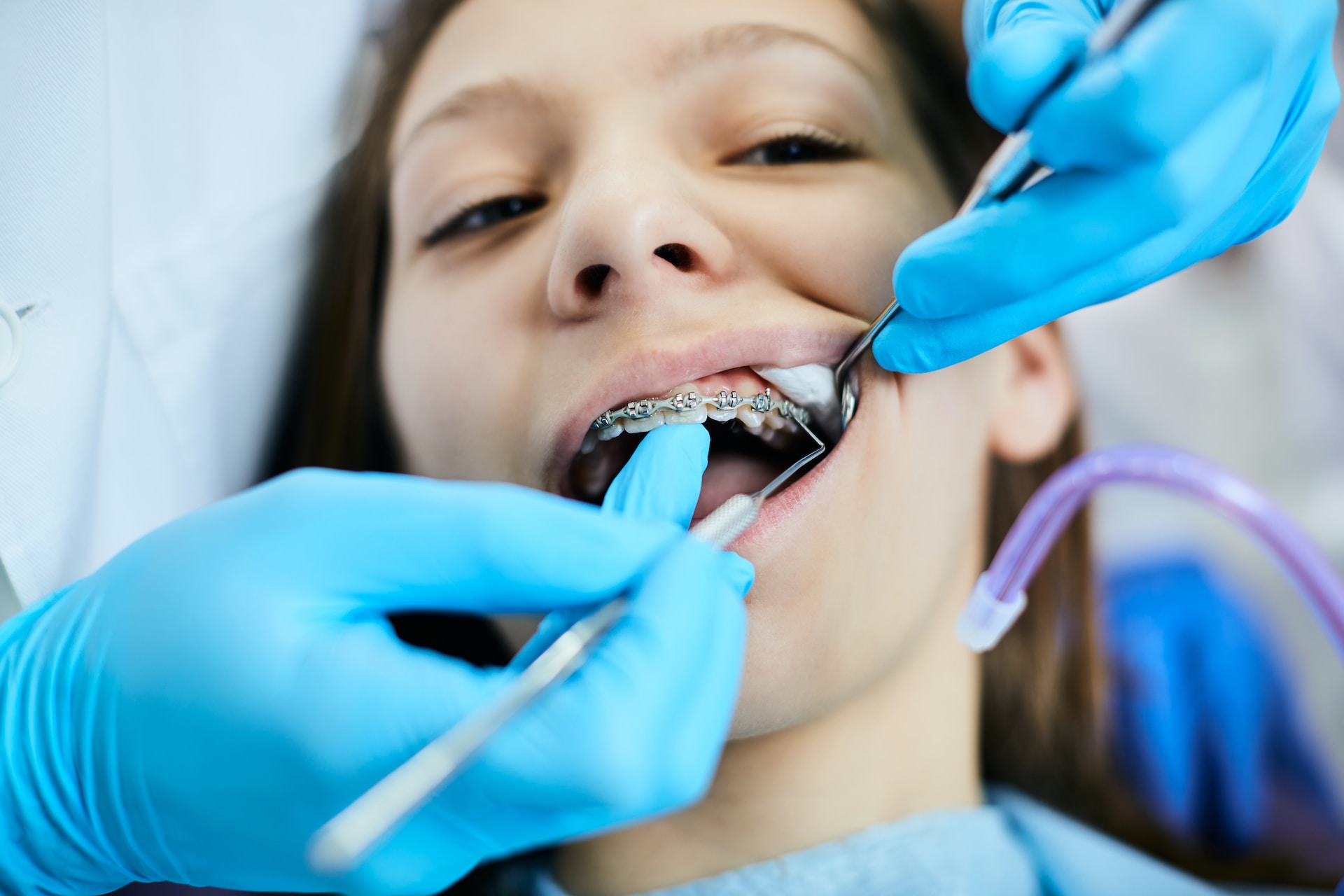 Avoiding Dental Disasters: Common Mistakes to Sidestep When Choosing a Dental Expert in Rolla, Missouri