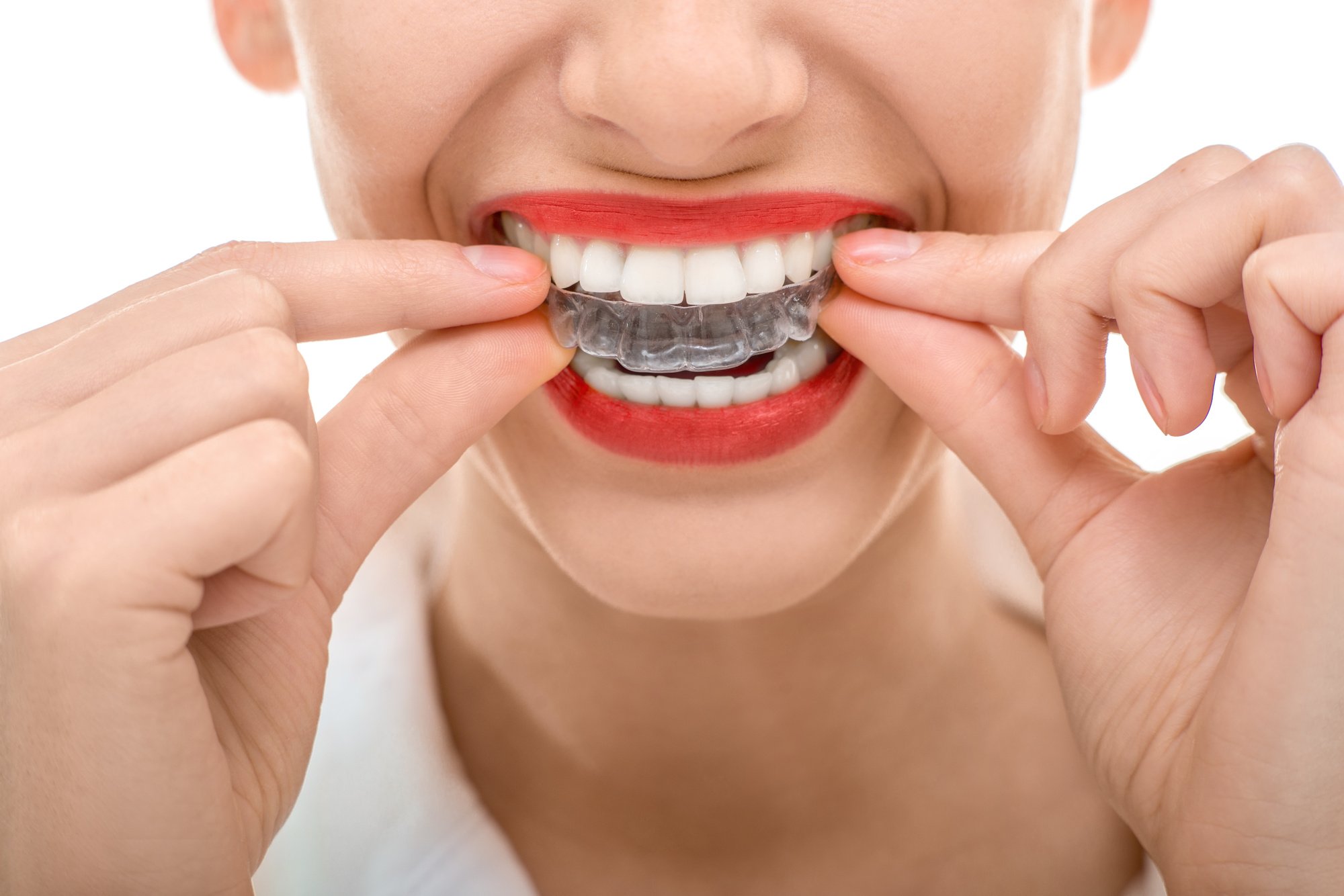 You are able to achieve a smile that is not only attractive but also in good oral health with the assistance of appropriate orthodontic procedures.